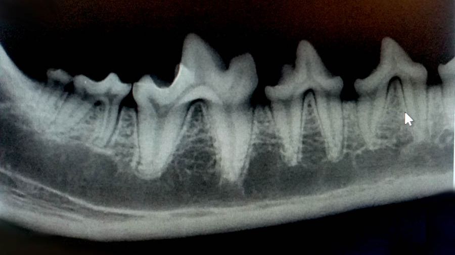 Zahnröntgen vom Unterkiefer